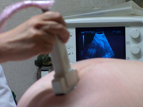 Photo of an ultrasound